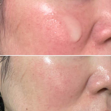 Skin Barrier Calming Lotion/Ongredients/乳液を使ったクチコミ(4枚目)