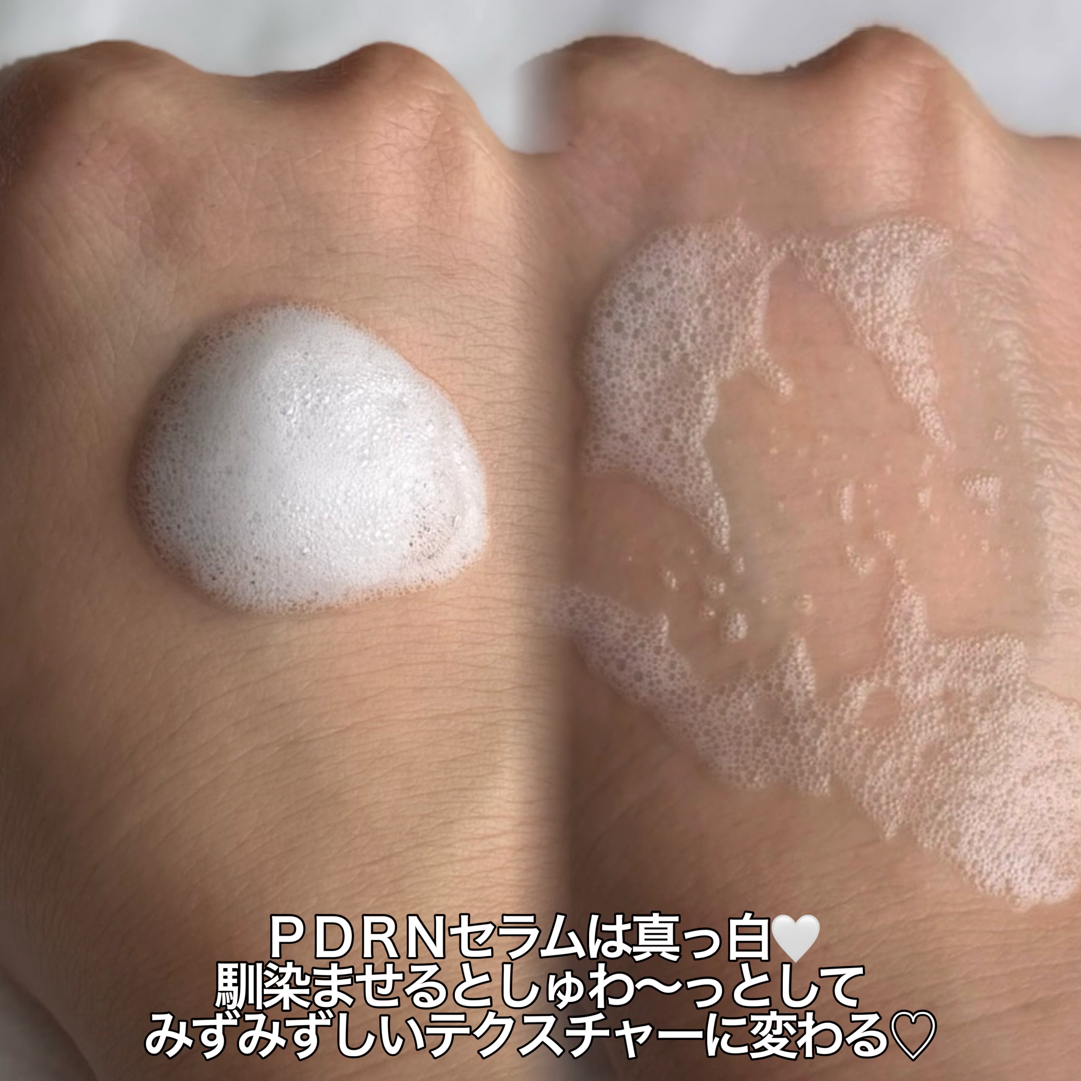 PDRN ヒアルロン酸 ミントマイクロバブルセラム/VT/美容液を使ったクチコミ（2枚目）