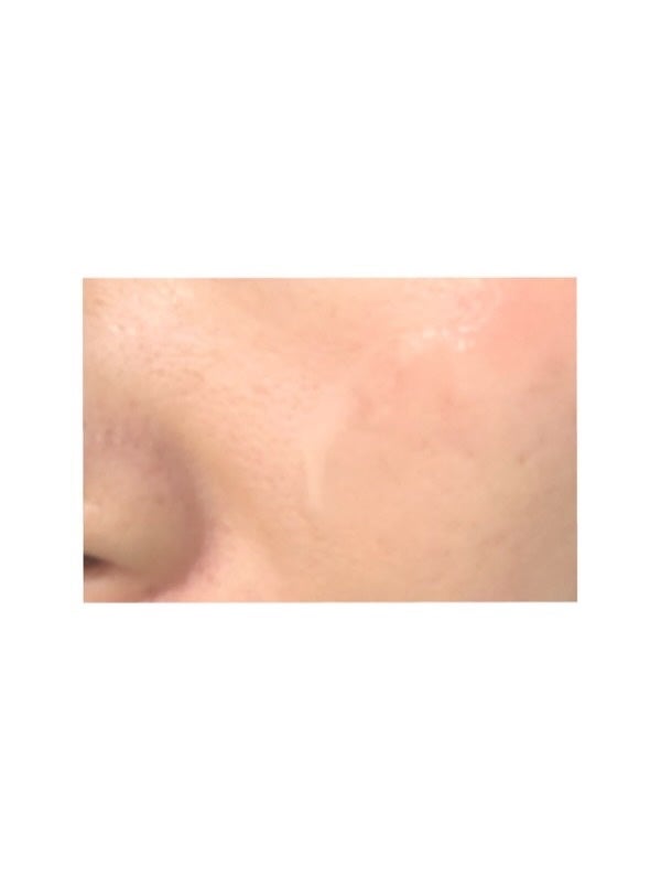 リズムコンセントレート/AYURA/美容液を使ったクチコミ(4枚目)