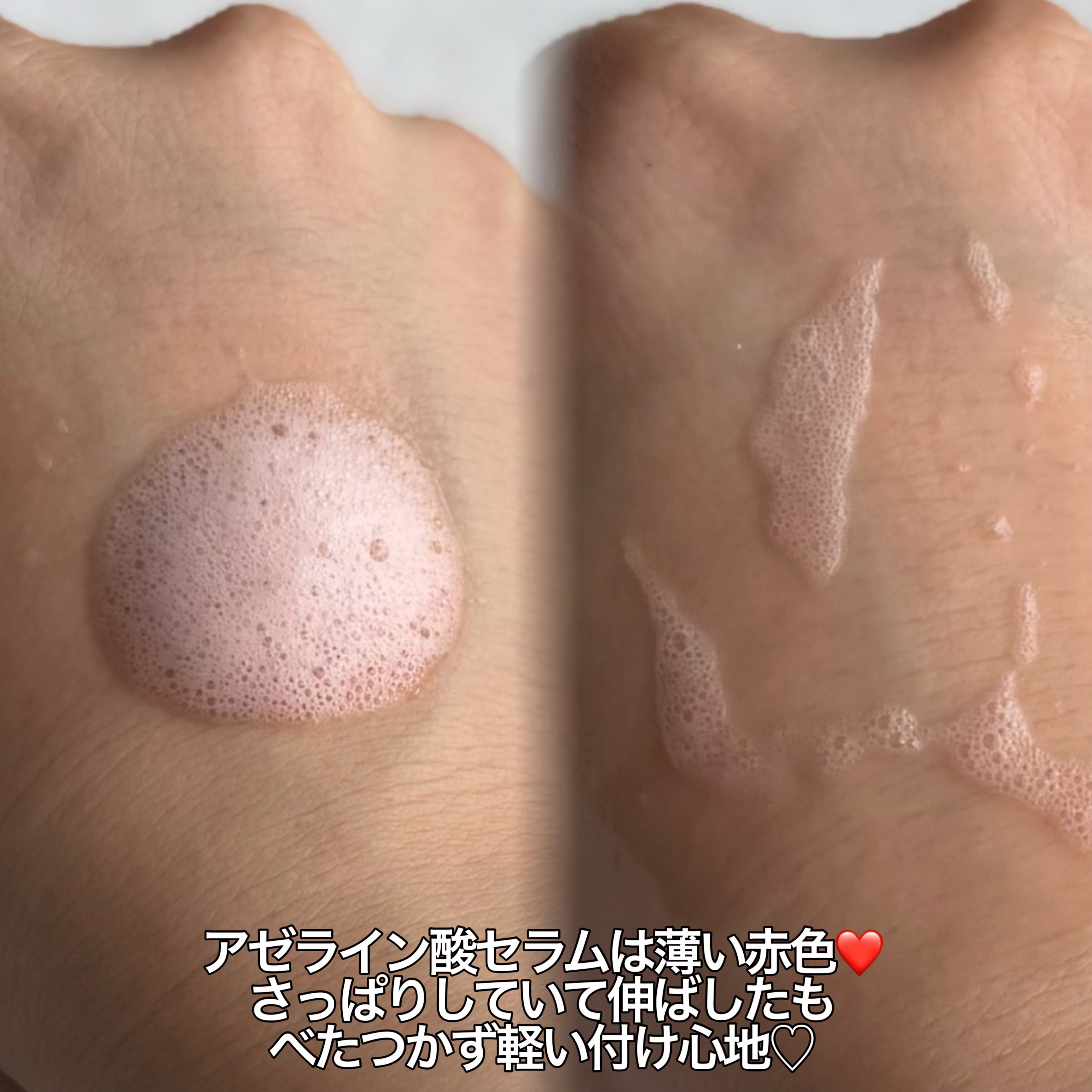 PDRN ヒアルロン酸 ミントマイクロバブルセラム/VT/美容液を使ったクチコミ（3枚目）