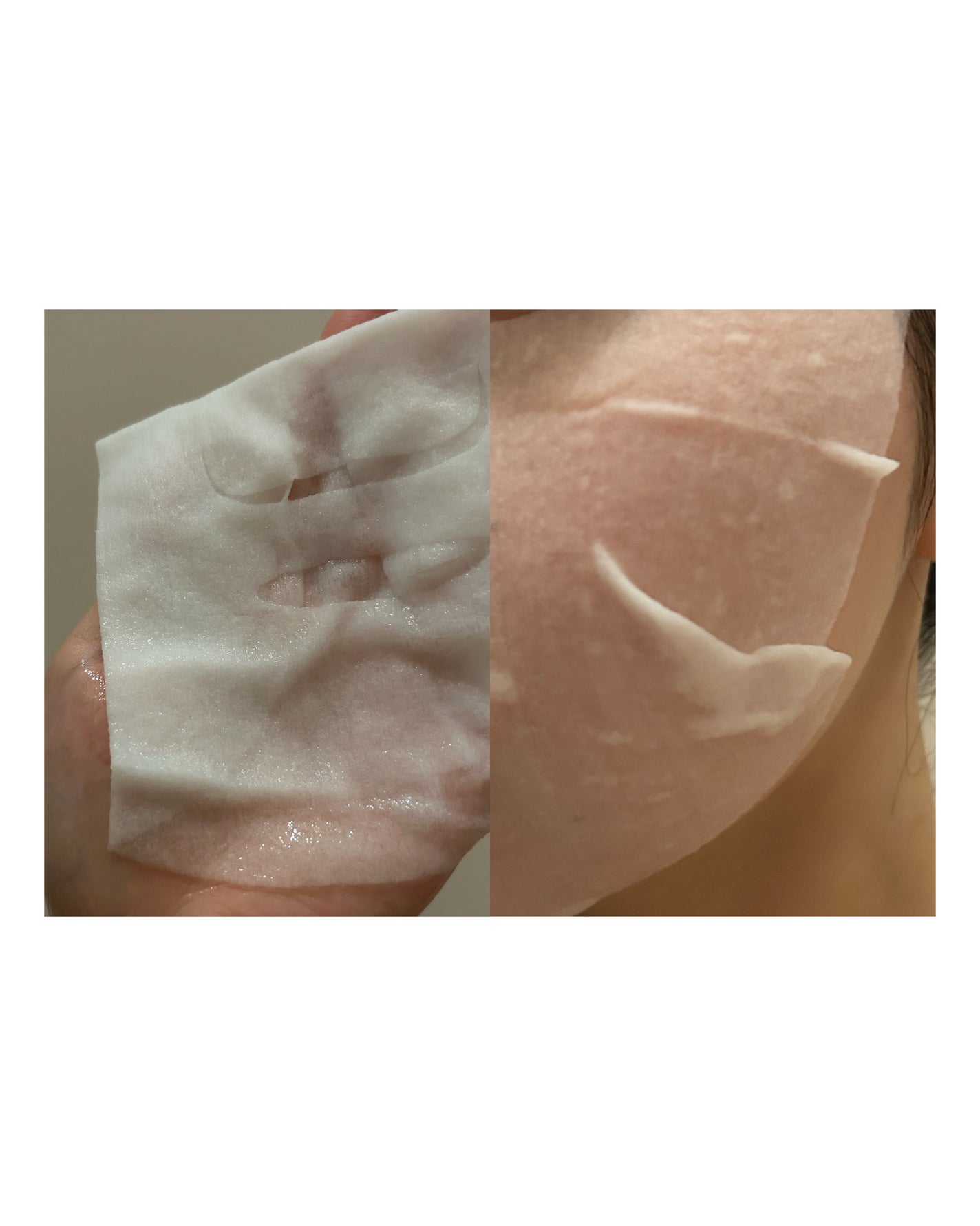 ルルルン ハイドラ V マスク/ルルルン/シートマスク・パックを使ったクチコミ(2枚目)