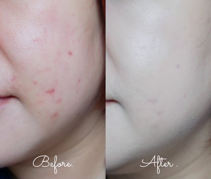 ソフトシアーマルチパレット/wakemake/アイシャドウパレットを使ったクチコミ(4枚目)