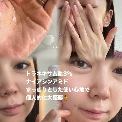 TXナイアシンエッセンストナー/SKIN&LAB/化粧水を使ったクチコミ(2枚目)
