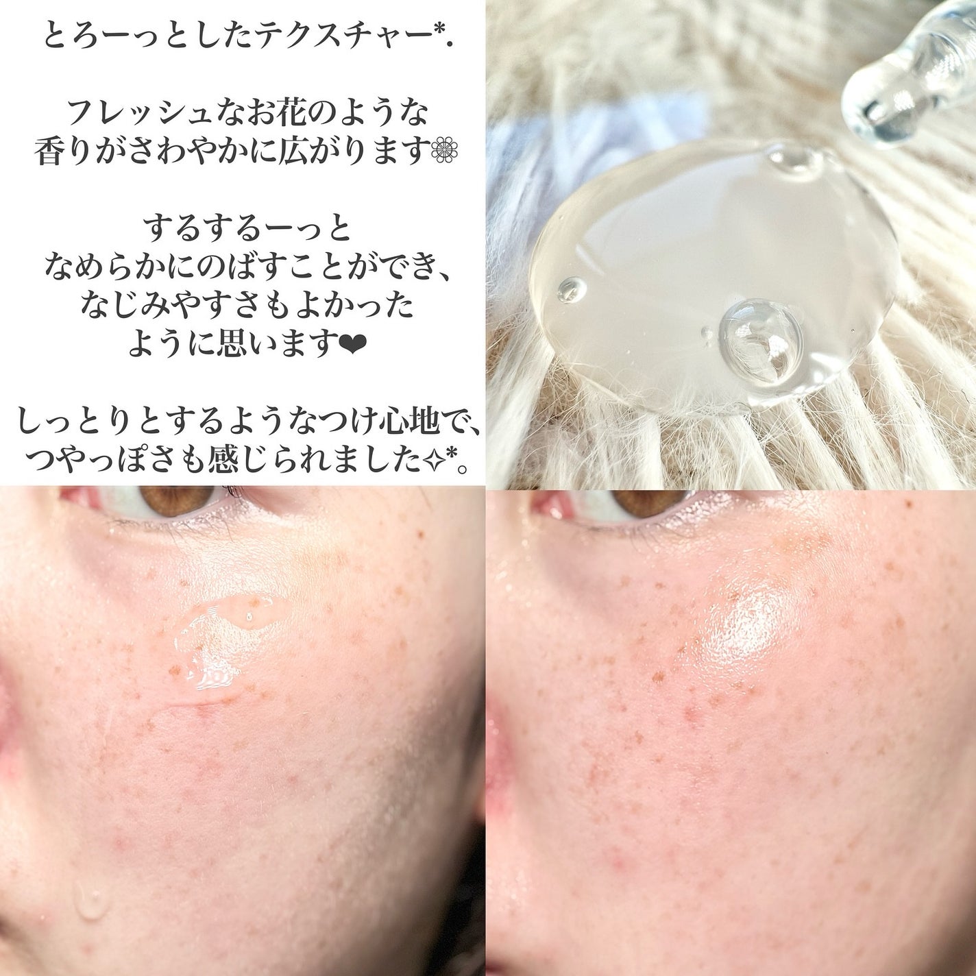 スノーアンプル/CHARDE/美容液を使ったクチコミ(3枚目)