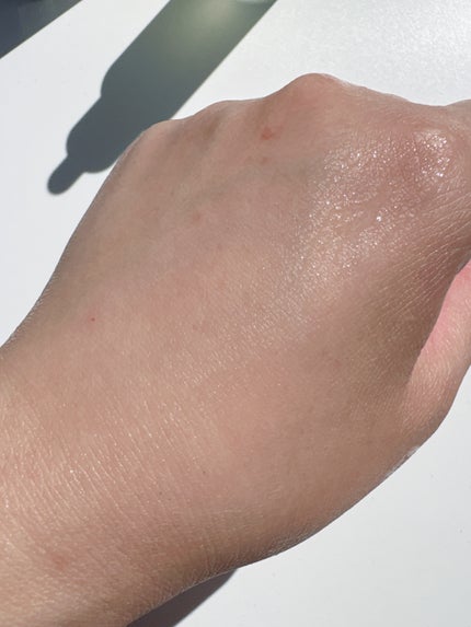 LEPOREM アゼライン酸ACセラム スタンダード/LEPOREM/美容液を使ったクチコミ(5枚目)