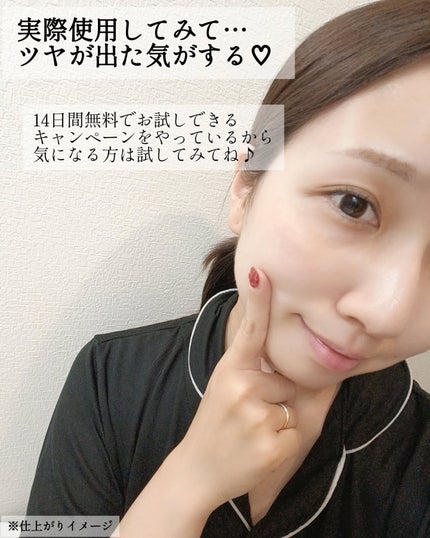 LED美容器 エクスイディアル/美顔器・マッサージを使ったクチコミ(8枚目)