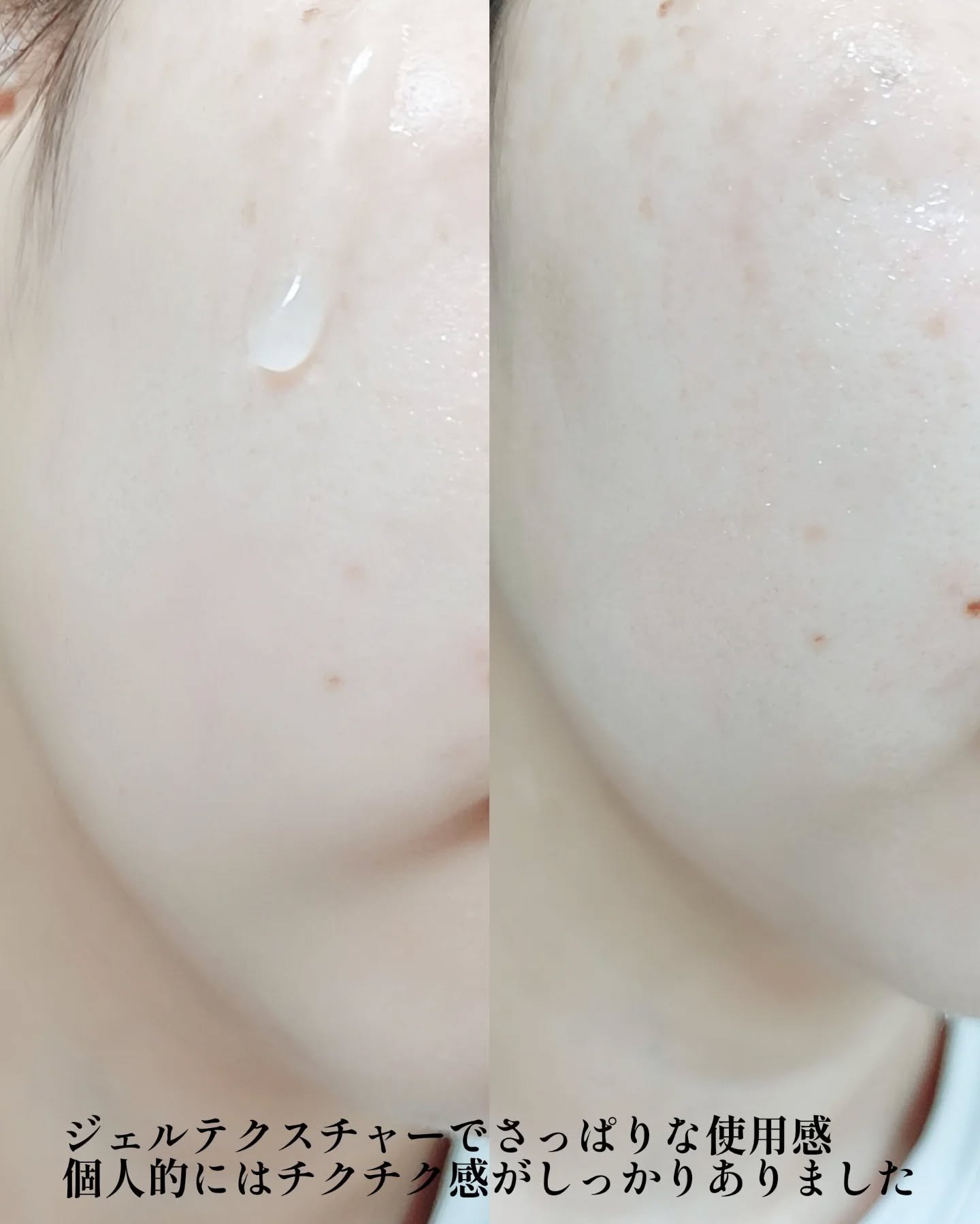 Derma VC Serum/&meu/美容液を使ったクチコミ（3枚目）