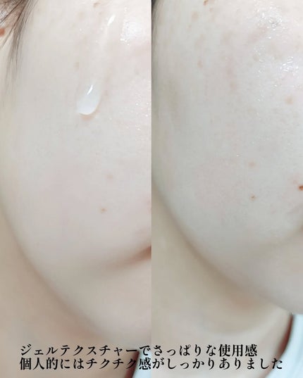 Derma VC Serum/&meu/美容液を使ったクチコミ(3枚目)