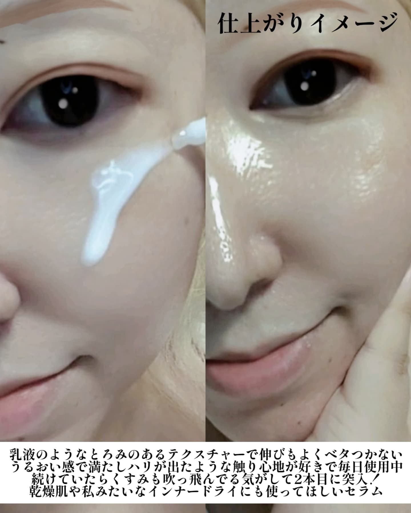 シカレチA エッセンス0.1/VT/美容液を使ったクチコミ（3枚目）