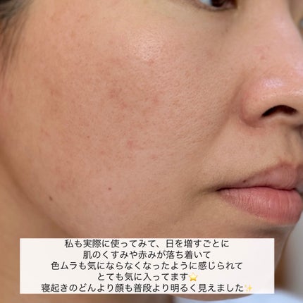 HAKU メラノフォーカスIV/HAKU/美容液を使ったクチコミ(7枚目)