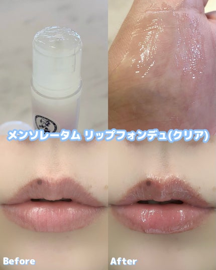 メンソレータム リップフォンデュ/メンソレータム/リップバームを使ったクチコミ(2枚目)