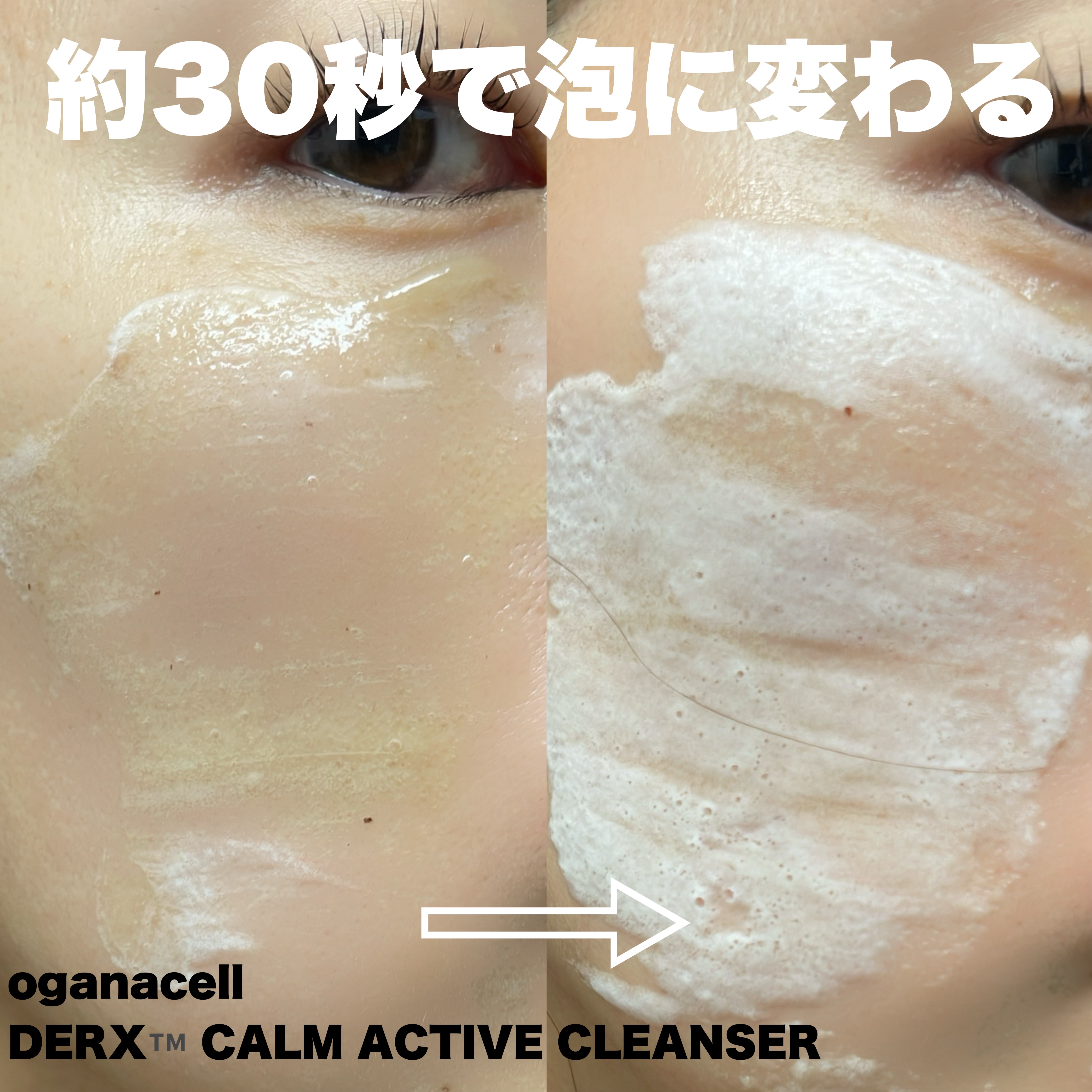 ダーマアールエックス カム アクティブ クレンザー/OGANACELL/クレンジングジェルを使ったクチコミ（3枚目）
