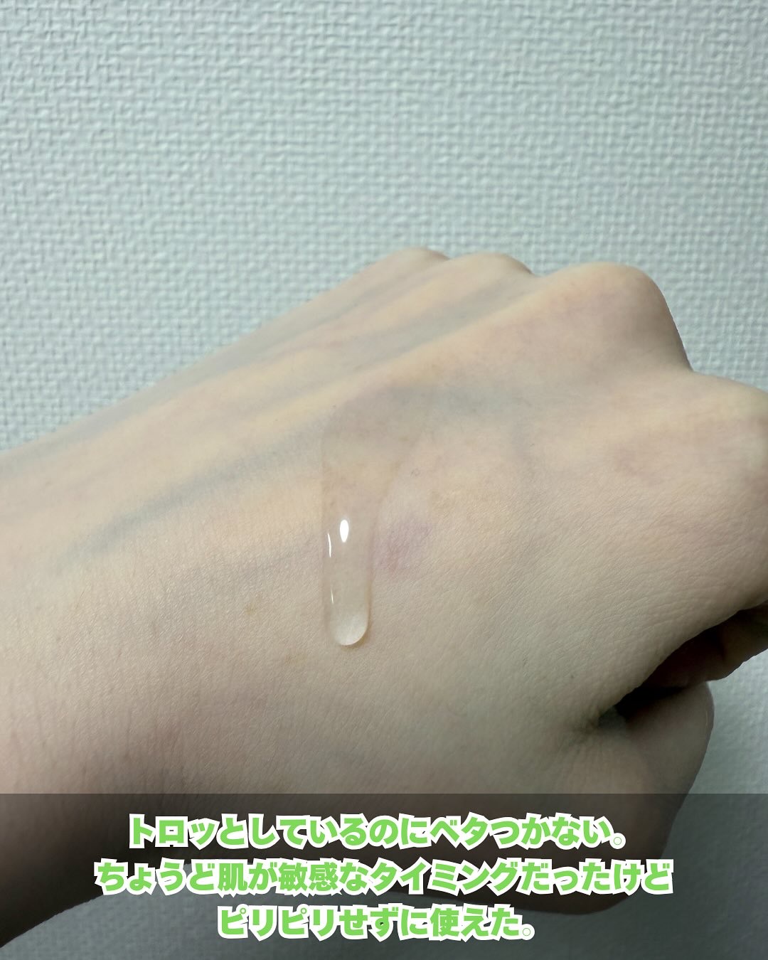 ノスカナイン トラブル セラム/FATION/美容液を使ったクチコミ（3枚目）