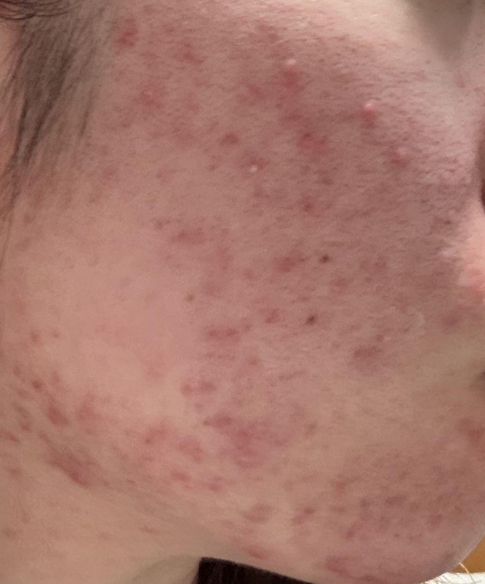 乳液 ＮＣ/なめらか本舗/乳液を使ったクチコミ（2枚目）