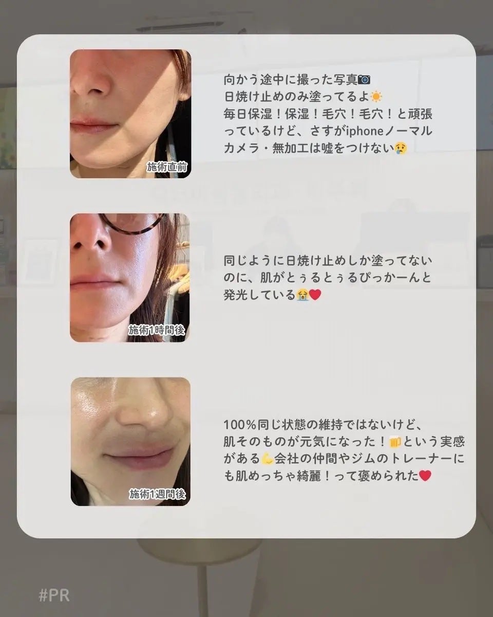 ã±ãð¥ : ãã©ããð¯ð«¶ on LIPS ãËËËèã®åºåãã»ããšã«å€ãã£ããËËËãã¯ã¿ãŒçŸæŽåœ¢å€ç§ð¥L..ãïŒ4æç®ïŒ