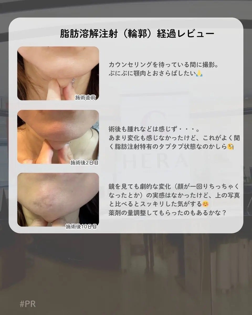 ã±ãð¥ on LIPS ã:Ëâ§èèªæº¶è§£æ³šå°(茪é)çµéã¬ãâ§Ë:ãPRãæ°æ²é§
..ãïŒ3æç®ïŒ