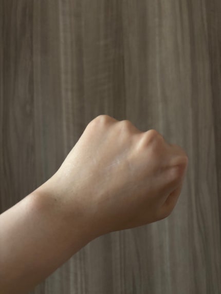 せーか on LIPS 「先日韓国でポテンツァ受けてきました🥰いっつも施術後のケアどうし..」(6枚目)