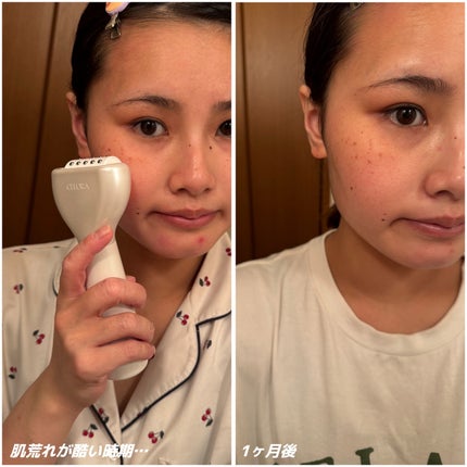 ペンタショット/CELORABY/美顔器・マッサージを使ったクチコミ(2枚目)