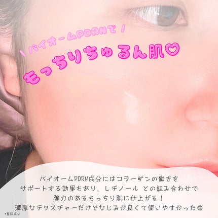 ReDRNエクソソームアンプル/Dr.nineteen/美容液を使ったクチコミ(5枚目)