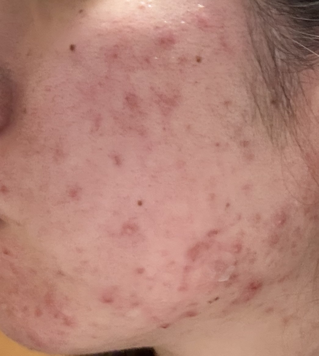 乳液 ＮＣ/なめらか本舗/乳液を使ったクチコミ（3枚目）