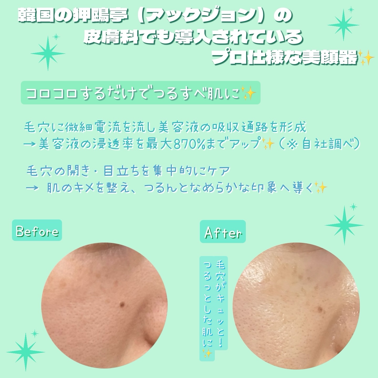 ポアタイトニングブーストセラム/CELORABY/美容液を使ったクチコミ（2枚目）