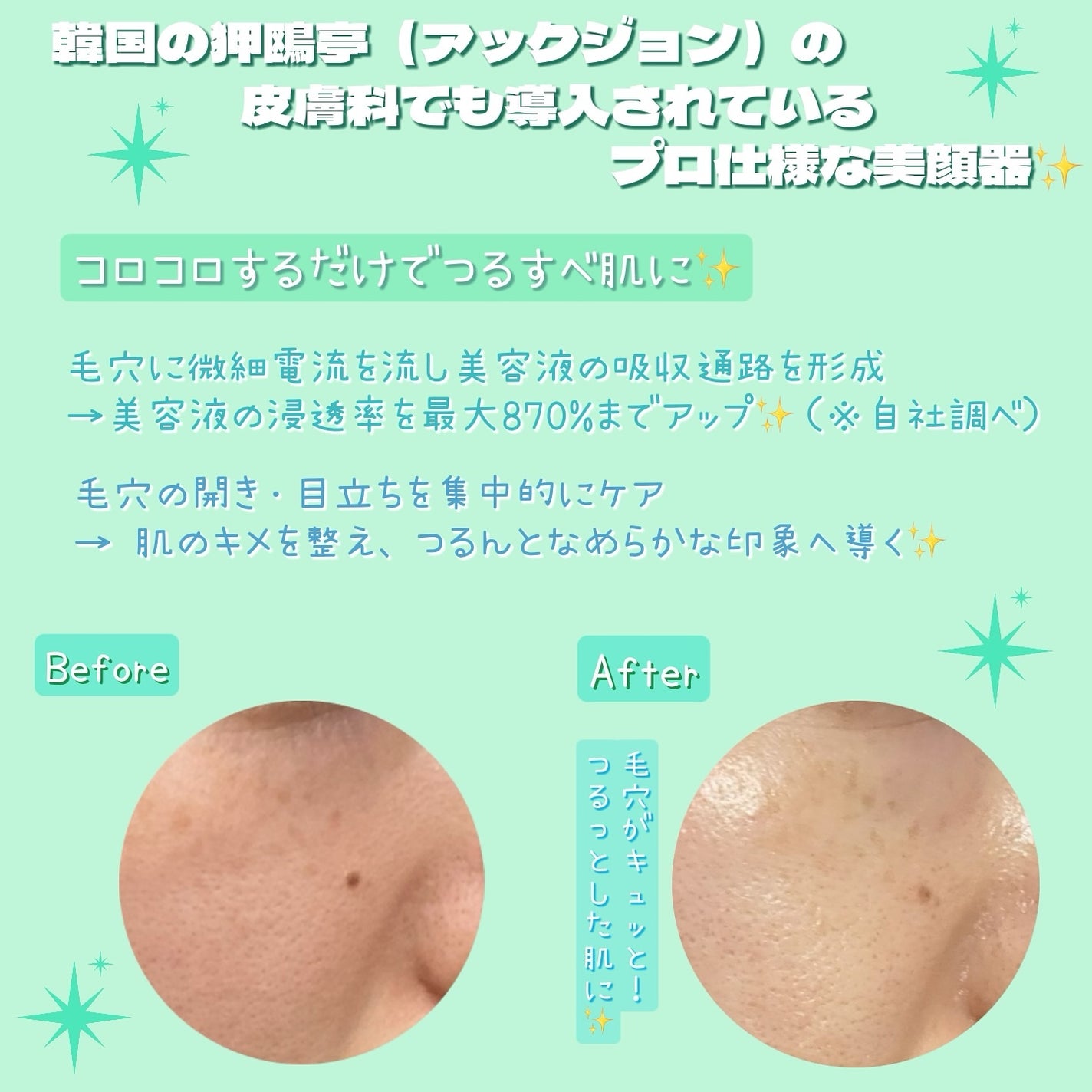 ポアタイトニングブーストセラム/CELORABY/美容液を使ったクチコミ(2枚目)