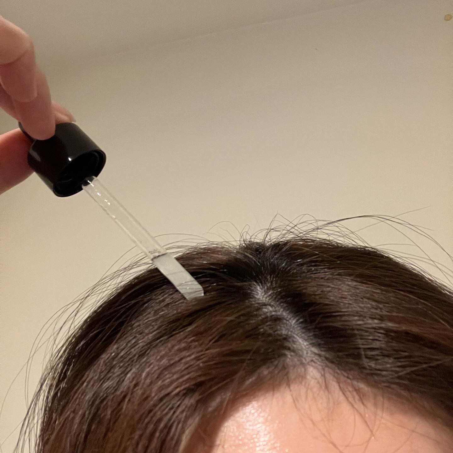 薬用 メディカル アンチヘアロスセラム/L'OCCITANE/頭皮ローションを使ったクチコミ（3枚目）