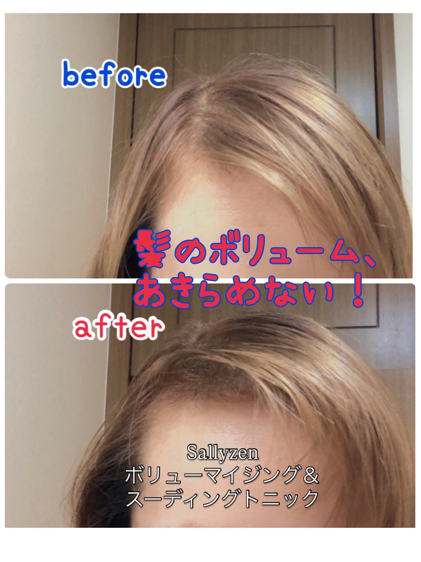 ボリューマイジング&スーディングヘアトニック/SallyZen/頭皮ローションを使ったクチコミ（1枚目）