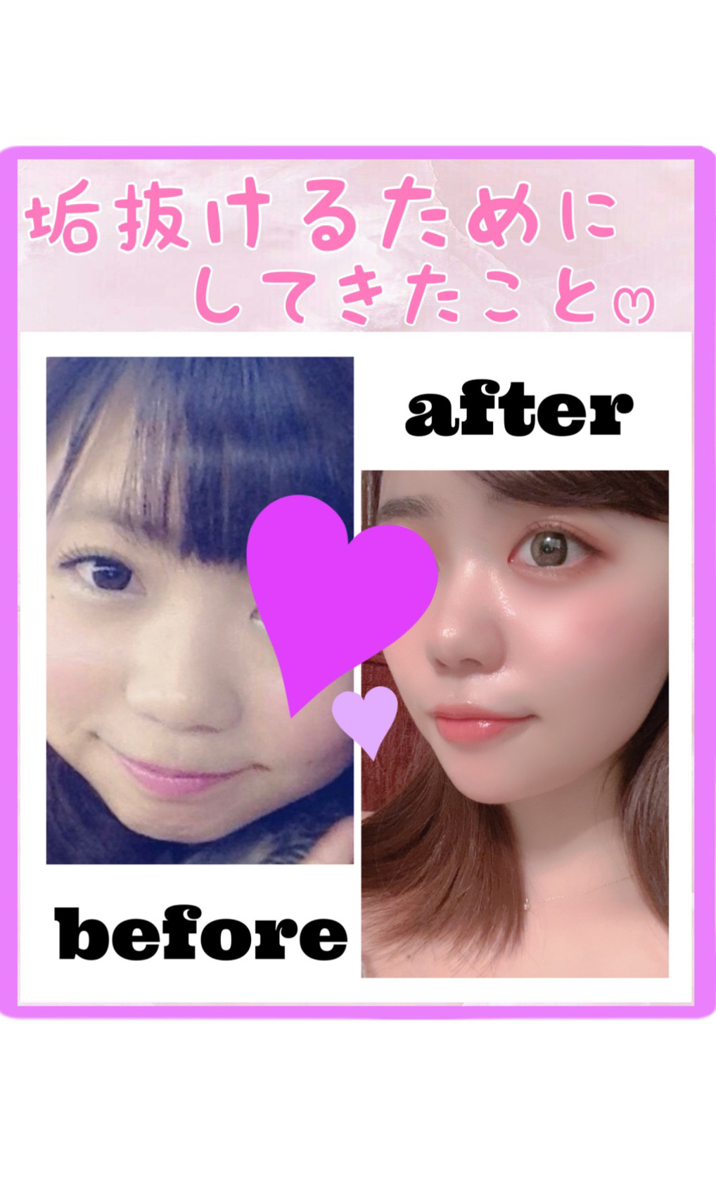 ケイト リップモンスター/KATE/口紅を使ったクチコミ（2枚目）