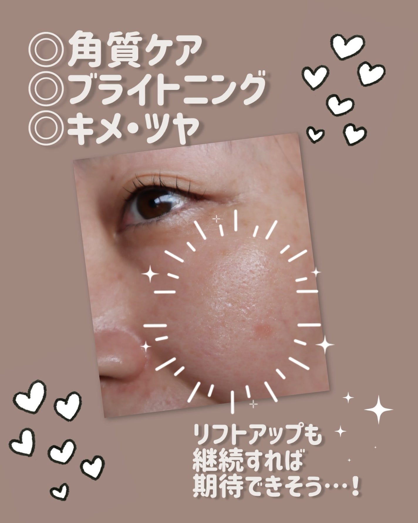 デュイセル プライベートケアマスク/DEWYCEL/シートマスク・パックを使ったクチコミ(5枚目)