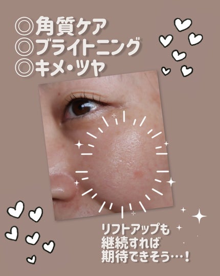 デュイセル プライベートケアマスク/DEWYCEL/シートマスク・パックを使ったクチコミ(5枚目)