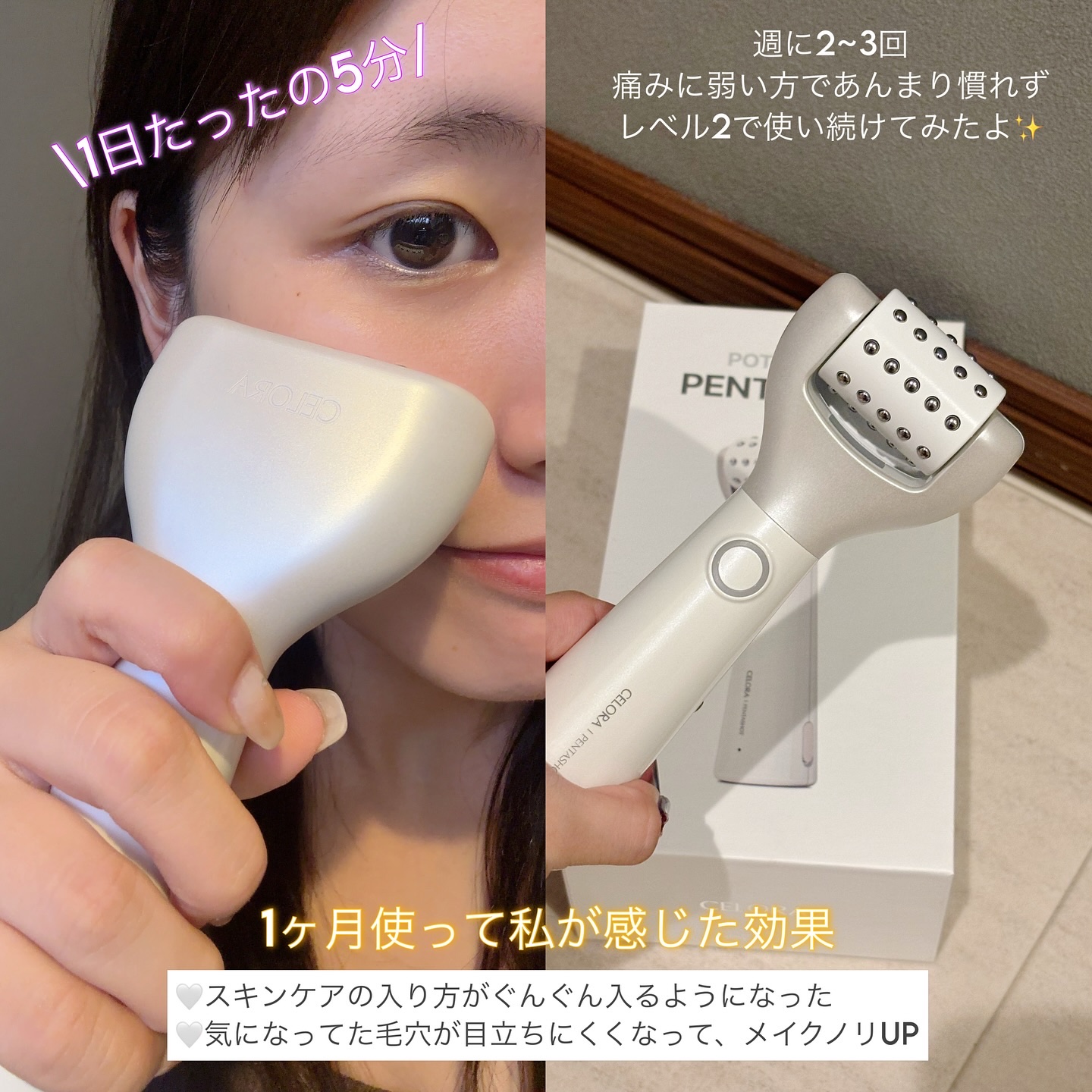 【美品】セロラバイ　CELORA ポテンシア ペンタショット 美顔器 楽天市場】24日までP10倍UP!☆楽天1位 美顔器 韓国エステ 美容