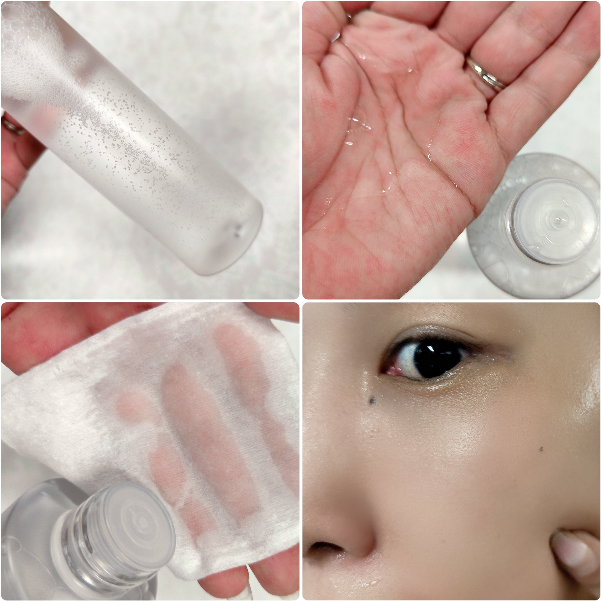 ビタ5Xシカチノールアンプルトナー/D'amu/化粧水を使ったクチコミ（3枚目）