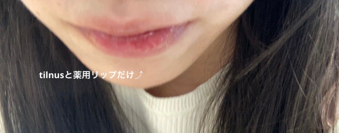 薬用リップスティックXD/メンソレータム/リップクリームを使ったクチコミ(4枚目)