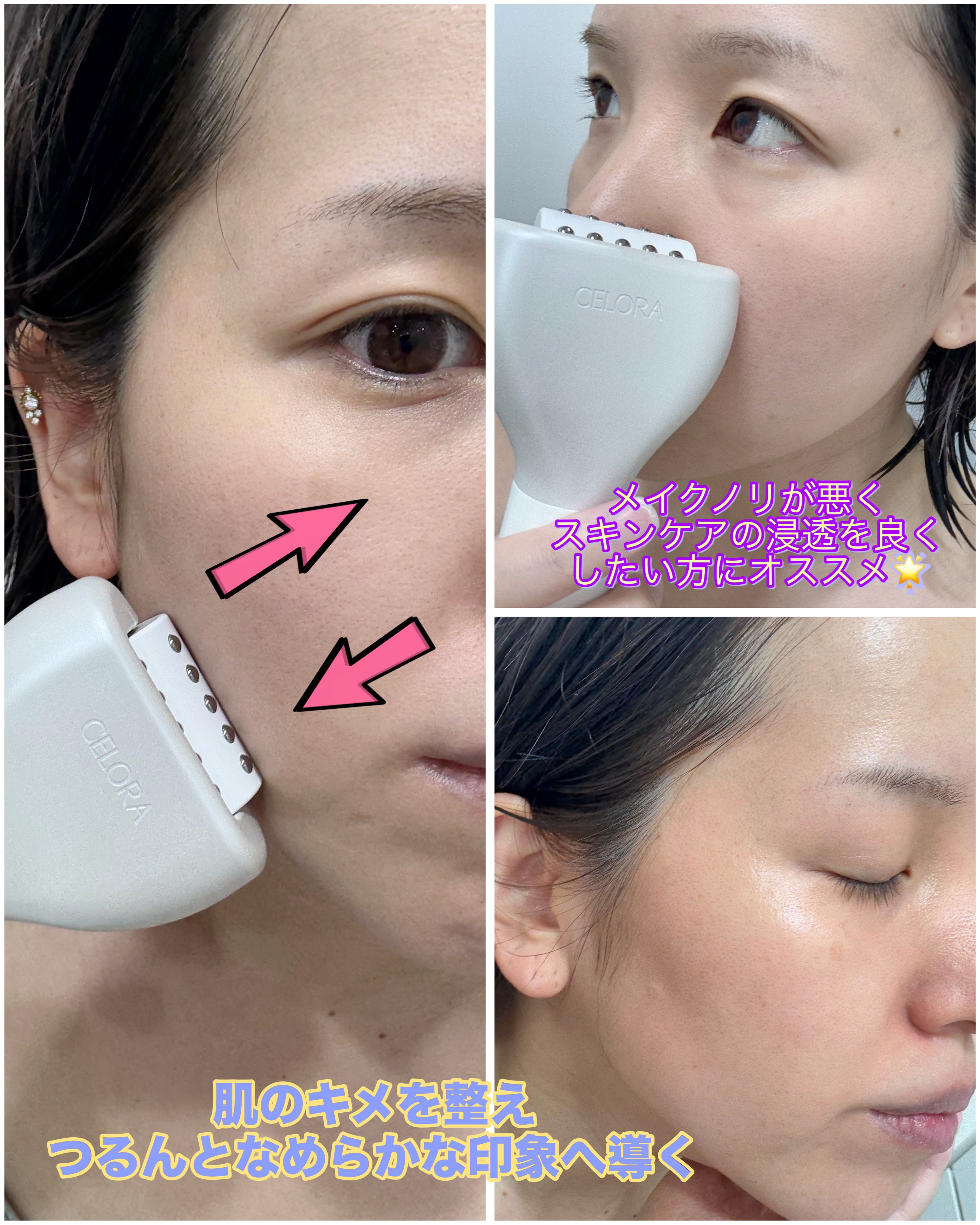 ペンタショット/CELORABY/美顔器・マッサージを使ったクチコミ（3枚目）