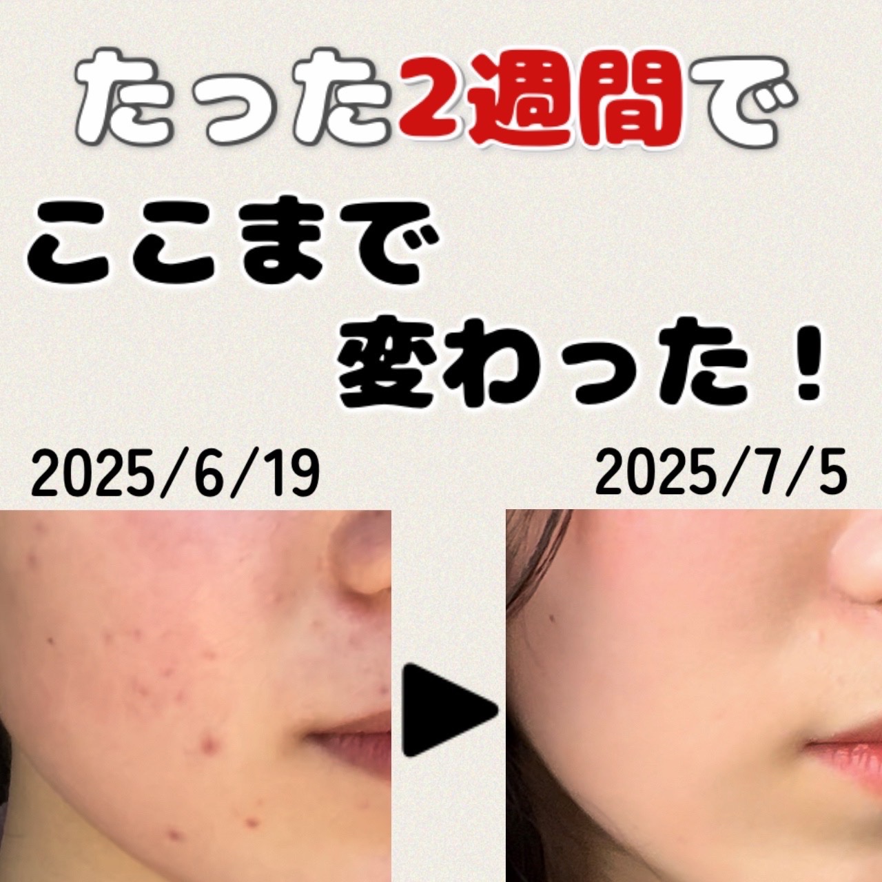 トリートメントミルク（ブライトニング） しっとり/アクアレーベル/乳液を使ったクチコミ（2枚目）