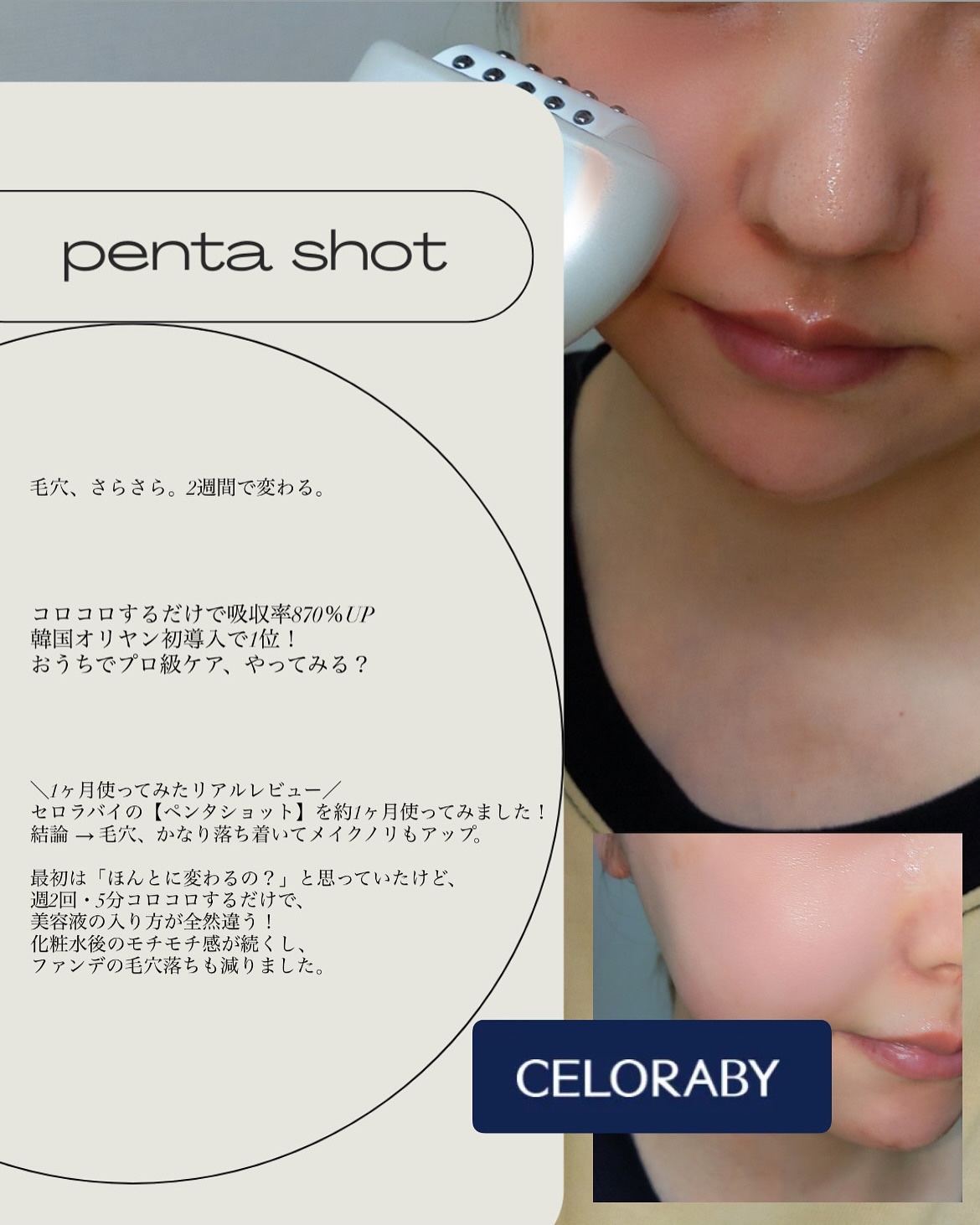 ペンタショット｜CELORABYの効果に関する口コミ - ＼1ヶ月使ってみた