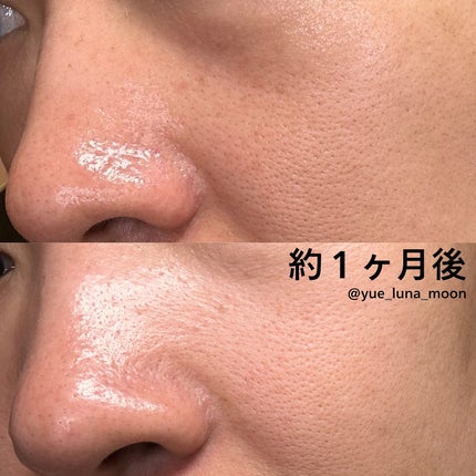 ペンタショット/CELORABY/美顔器・マッサージを使ったクチコミ(3枚目)