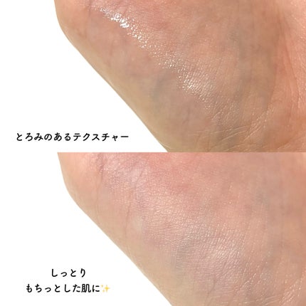 グルタチオンアンプルトナー/SKIN&LAB/化粧水を使ったクチコミ(3枚目)