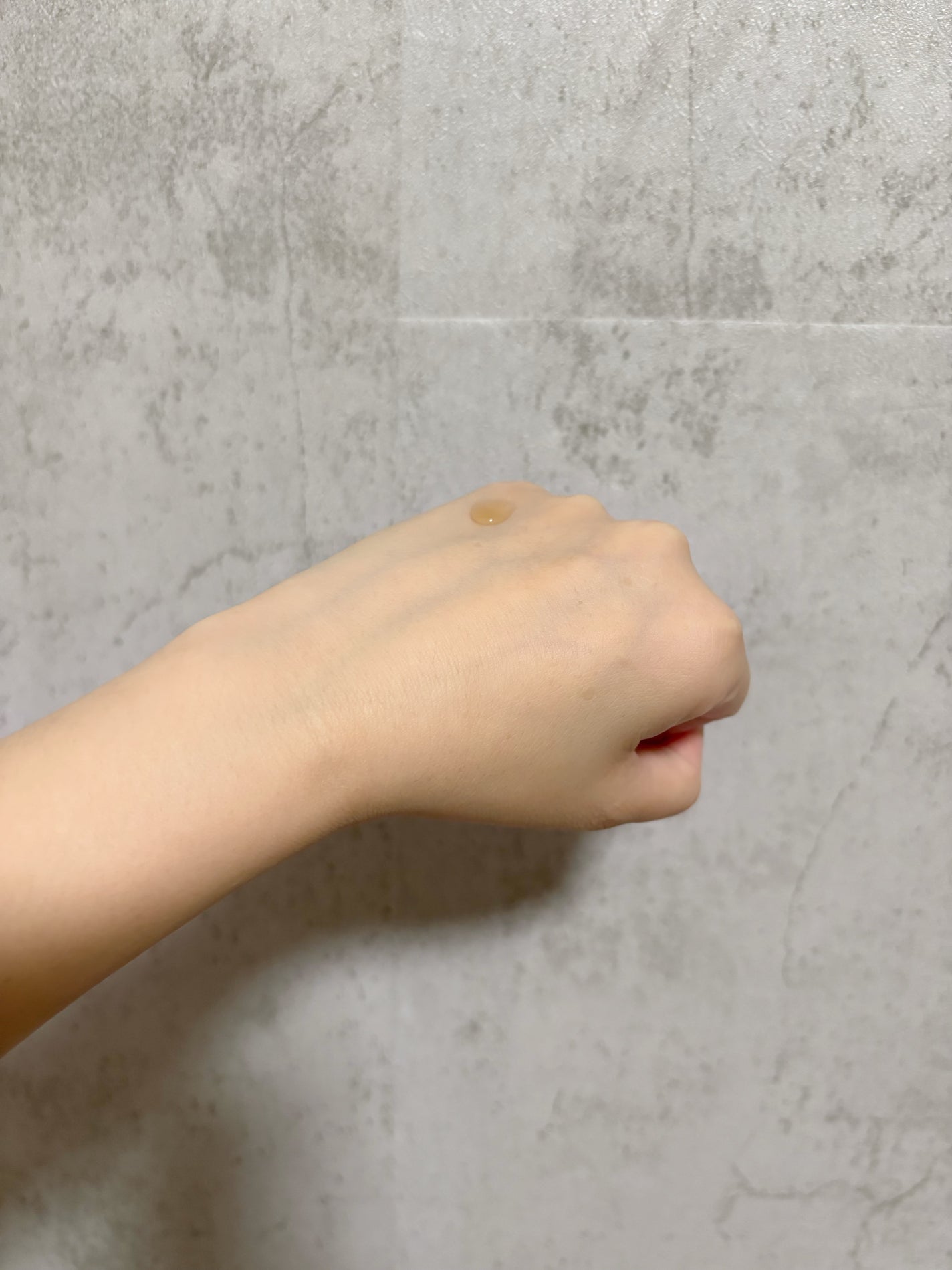 RXザ・アルファアルブチン2 ニキビ跡ケアセラム/COSRX/美容液を使ったクチコミ(6枚目)