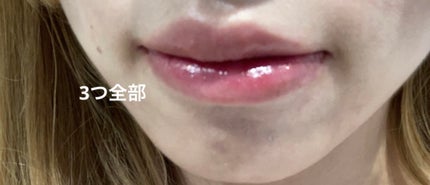 薬用リップスティックXD/メンソレータム/リップクリームを使ったクチコミ(5枚目)