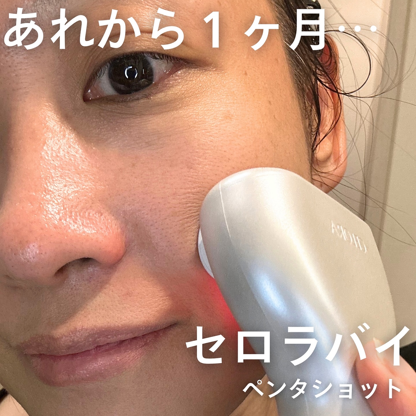 ペンタショット/CELORABY/美顔器・マッサージを使ったクチコミ（1枚目）