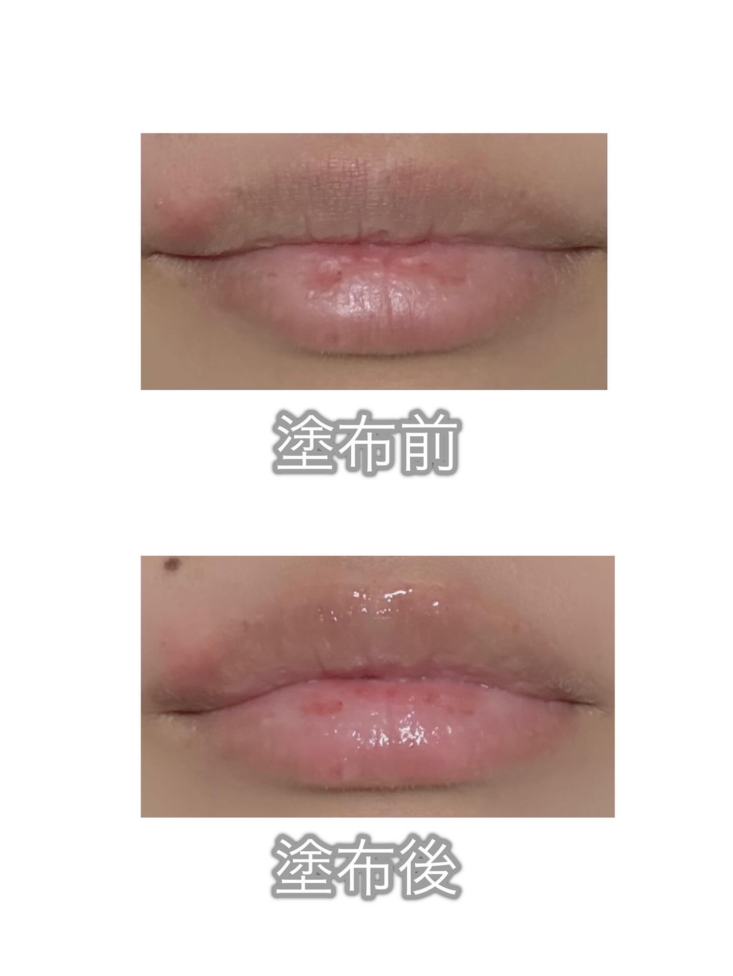 キューミ―ボムショットリッププランパー/AGARISM/リッププランパーを使ったクチコミ（3枚目）