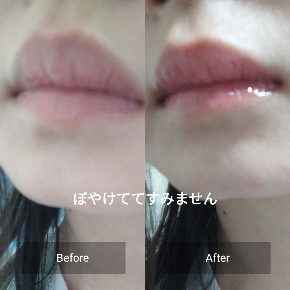 ニードルプランパー 高熱フィグ/Ui2./リッププランパーを使ったクチコミ(5枚目)