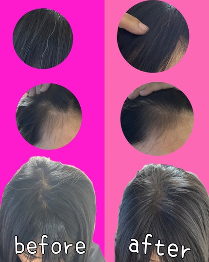 ETUDE ポンポンヘアシャドウのクチコミ「#etude  #pangpang 
ハゲ隠し!!
アイシャドウなみの持続力。こすれば消え.....」(3枚目)