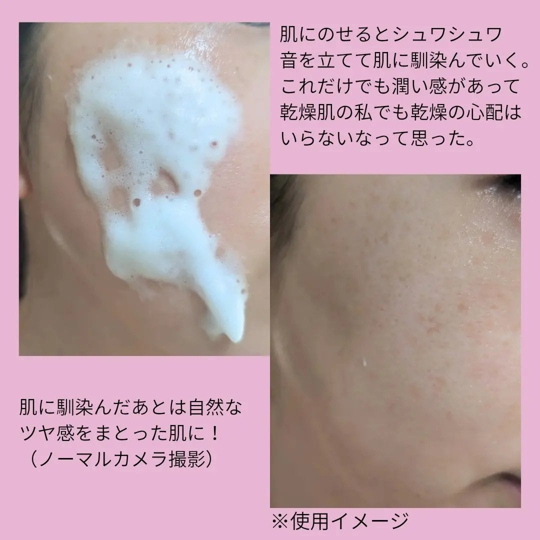 PDRNコラーゲンバブルセラム/CELORABY/美容液を使ったクチコミ(2枚目)