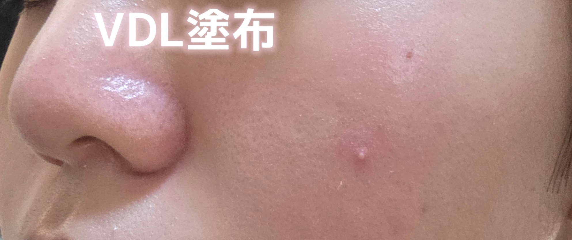 トーンステインカラーコレクティングプライマー/VDL/化粧下地を使ったクチコミ（2枚目）