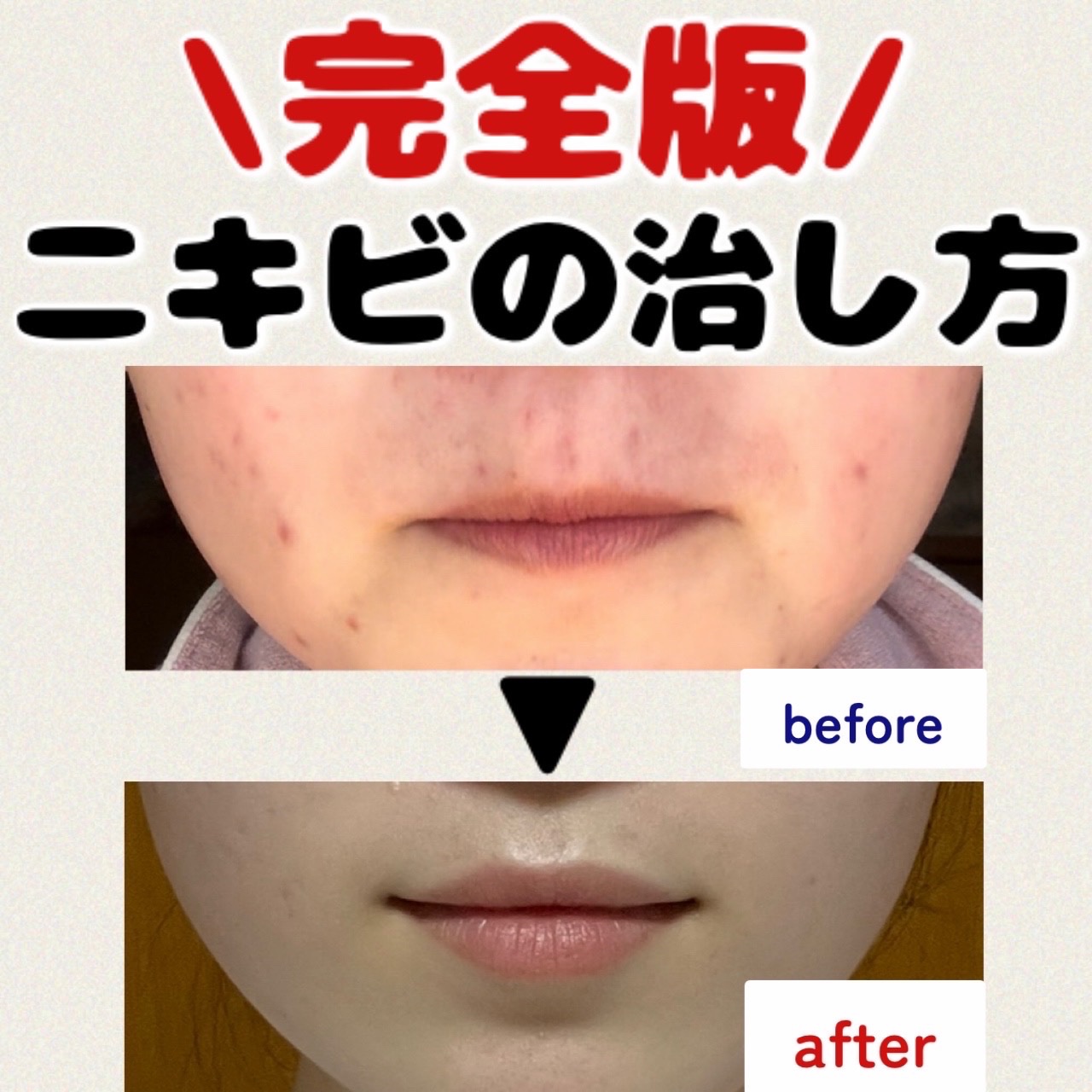 トリートメントミルク（ブライトニング） しっとり/アクアレーベル/乳液を使ったクチコミ（1枚目）