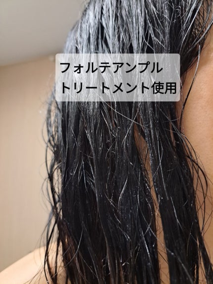 フォルテ アンプル トリートメント/treecell/洗い流すヘアトリートメントを使ったクチコミ(4枚目)
