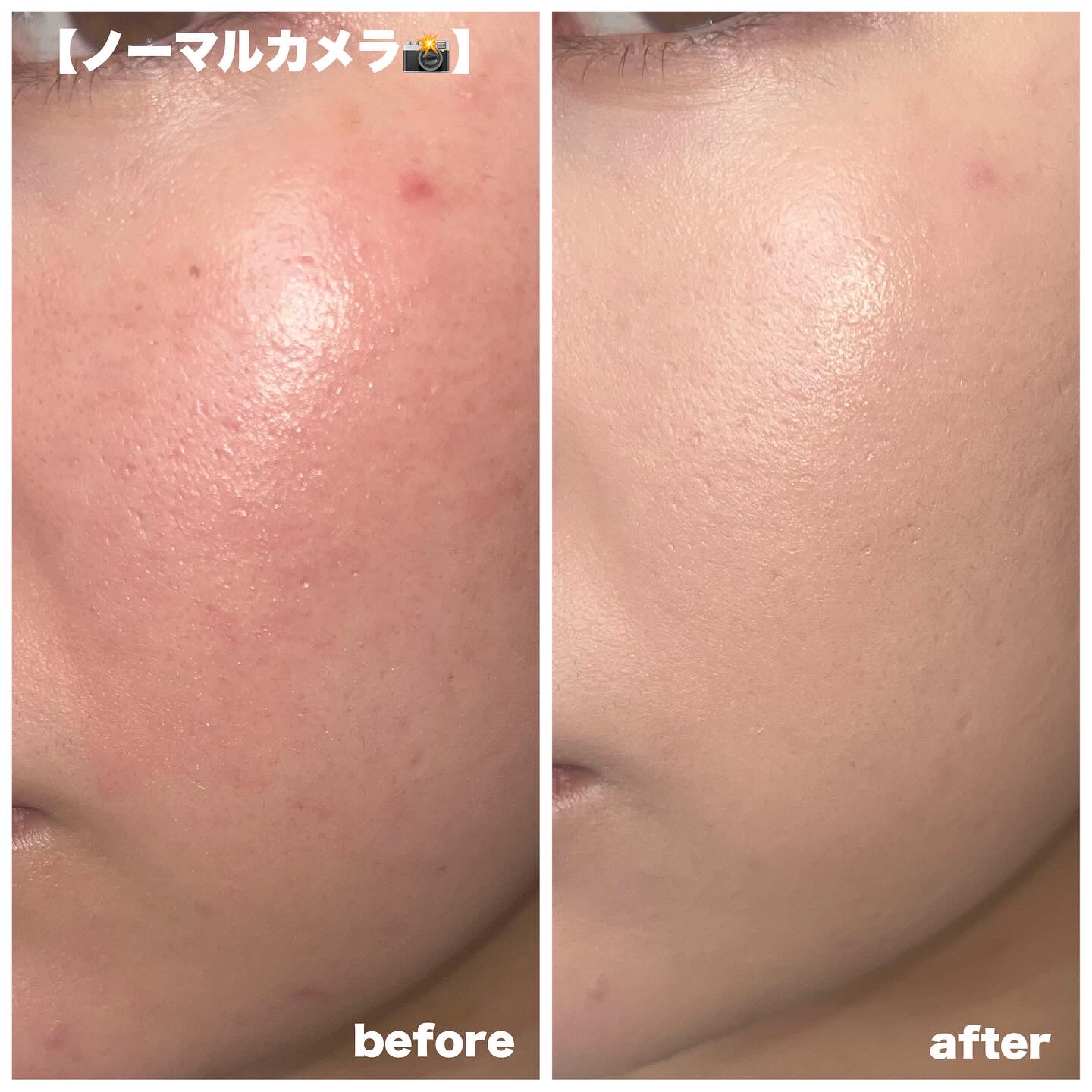 シームレスウェアクッション/wakemake/クッションファンデーションを使ったクチコミ（3枚目）